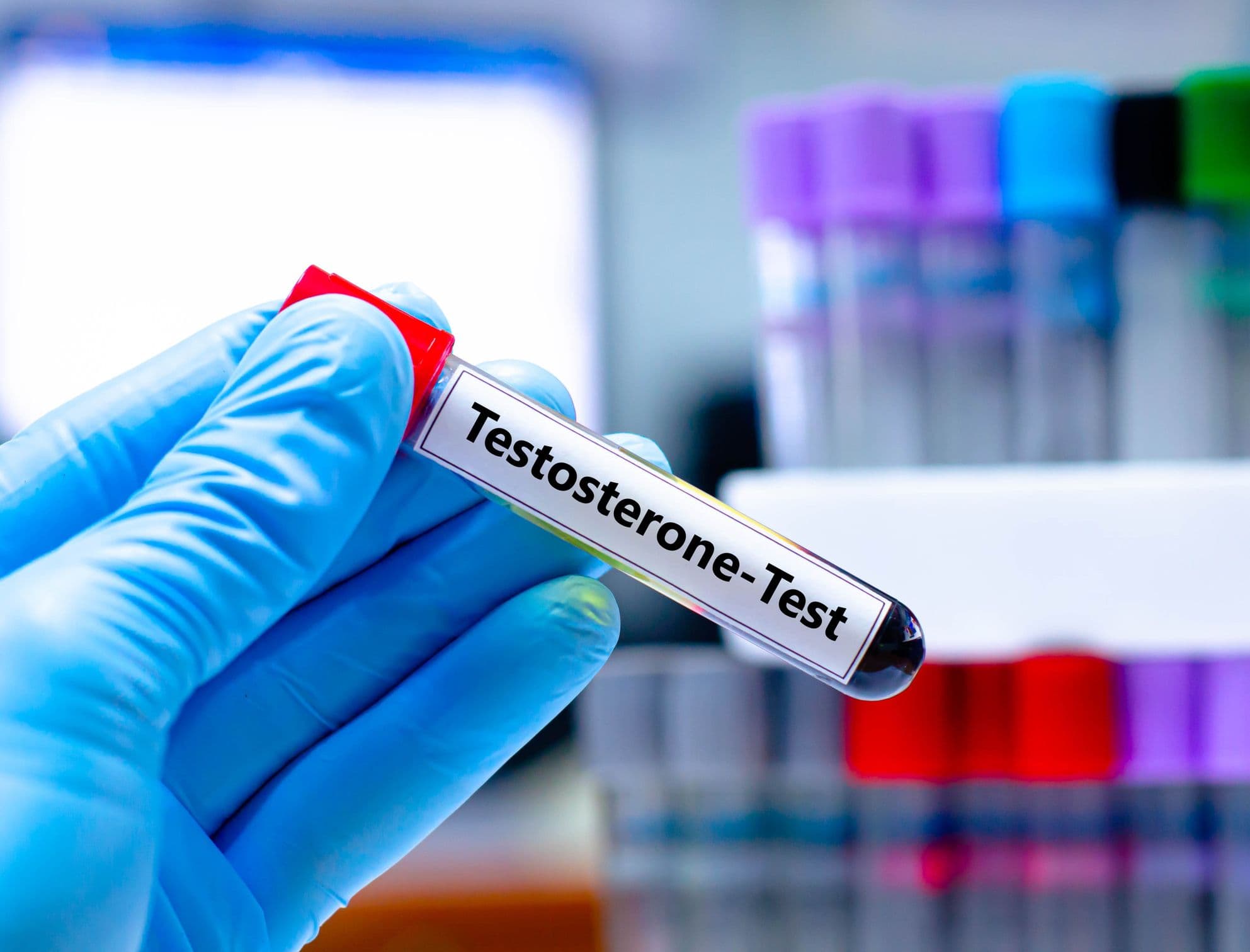 En hånd, der holder en testosterontest